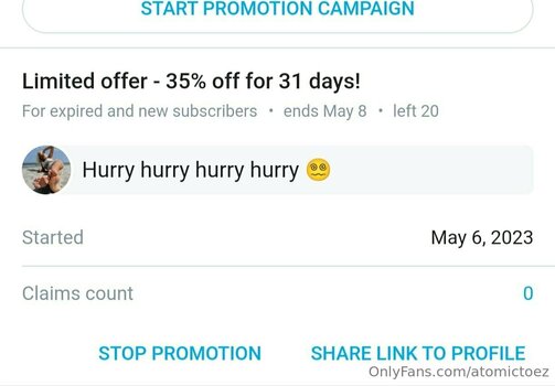 atomictoez / atomictoezz Nackt-Leaks OnlyFans Foto 13