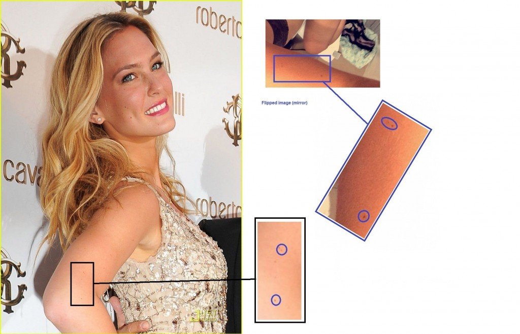 Bar-Refaeli-Foto-Beweise-Sommersprossen am Arm